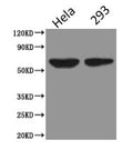 Western Blot
Positive WB detected in: Hela whole cell lysate, HEK293 whole cell lysate
All lanes: PODXL antibody at 2.5µg/ml
Secondary
Goat polyclonal to Mouse IgG at 1/5000 dilution
Predicted band size: 59, 56 kDa
Observed band size: 59 kDa