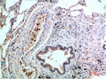 MAPK14 Monoclonal Antibody – Figure 1 of 1