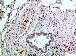 MAPK14 Monoclonal Antibody – Figure 1 of 1