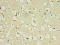 Immunohistochemistry of paraffin-embedded human brain using CSB-MA168601A0m in 30ug/ml dilute concentrations.