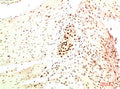 Immunohistochemical analysis of paraffin-embedded Human Colon Carcinoma Tissue using HP-1 α  Mouse mAb diluted at 1:200.