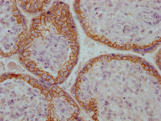 IHC image of CSB-MA196808 diluted at 1:100 and staining in paraffin-embedded human placenta tissue performed on a Leica BondTM system. After dewaxing and hydration, antigen retrieval was mediated by high pressure in a citrate buffer (pH 6.0). Section was blocked with 10% normal goat serum 30min at RT. Then primary antibody (1% BSA) was incubated at 4°C overnight. The primary is detected by a Goat anti-mouse IgG polymer labeled by HRP and visualized using 0.05% DAB.