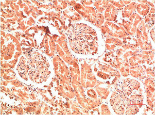 COL4A1 Monoclonal Antibody – Figure 1 of 2