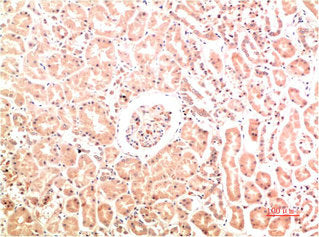 Immunohistochemical analysis of paraffin-embedded Human Kidney Tissue using Collagen IV  Mouse mAb diluted at 1:200.