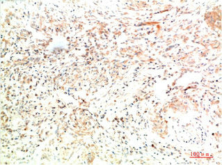 COL2A1 Monoclonal Antibody – Figure 1 of 1