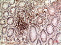 Immunohistochemical analysis of paraffin-embedded Human Colon Carcinoma Tissue using Epsilon Tubulin Mouse mAb diluted at 1:200.