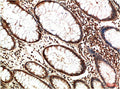 ATM Monoclonal Antibody – Figure 1 of 2