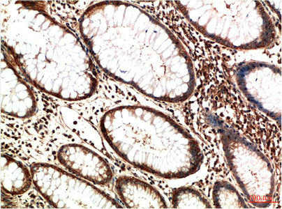 ATM Monoclonal Antibody – Figure 1 of 2