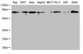 Western Blot
Positive WB detected in: Raji whole cell lysate, 293T whole cell lysate, Hela whole cell lysate, HepG2 whole cell lysate, MCF-7 whole cell lysate, PC-3 whole cell lysate, U87 whole cell lysate, A549 whole cell lysate
All lanes: HSPA1A antibody at 1:1000
Secondary
Goat polyclonal to mouse IgG at 1/50000 dilution
Predicted band size: 71, 64 kDa
Observed band size: 71 kDa
Exposure time：5min