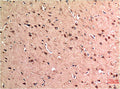 Immunohistochemical analysis of paraffin-embedded Human Brain Tissue using Beclin-1 Mouse mAb diluted at 1:200.