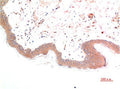 Immunohistochemical analysis of paraffin-embedded Human Skin Tissue using Phospho-Smad3(S425) Mouse mAb diluted at 1:200.