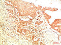 Acetyl-TP53(K382) Monoclonal Antibody – Figure 1 of 3