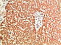 COL4A1 Monoclonal Antibody – Figure 1 of 2