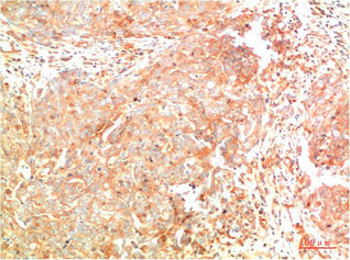 ATG7 Monoclonal Antibody – Figure 1 of 1