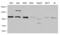 Western Blot
Positive WB detected in: U251 whole cell lysate, Hela whole cell lysate, A549 whole cell lysate, K562 whole cell lysate, HepG2 whole cell lysate, MCF-7 whole cell lysate, Jurkat whole cell lysate
All lanes: MBTPS1 antibody at 1:1000
Secondary
Goat polyclonal to mouse IgG at 1/50000 dilution
Predicted band size: 117 kDa
Observed band size: 117 KDa
Exposure time：5min