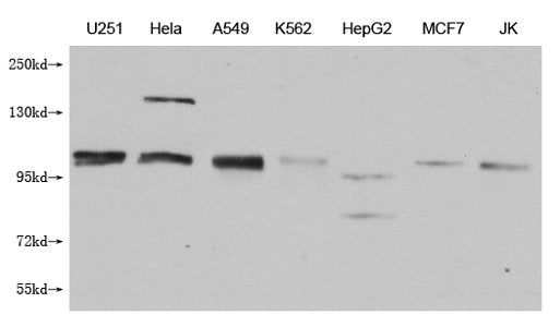 Western Blot
Positive WB detected in: U251 whole cell lysate, Hela whole cell lysate, A549 whole cell lysate, K562 whole cell lysate, HepG2 whole cell lysate, MCF-7 whole cell lysate, Jurkat whole cell lysate
All lanes: MBTPS1 antibody at 1:1000
Secondary
Goat polyclonal to mouse IgG at 1/50000 dilution
Predicted band size: 117 kDa
Observed band size: 117 KDa
Exposure time：5min