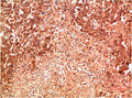 MAPK14 Monoclonal Antibody – Figure 1 of 1