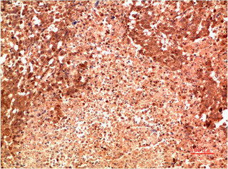 MAPK14 Monoclonal Antibody – Figure 1 of 1