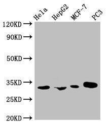 Western Blot
Positive WB detected in: Hela whole cell lysate, HepG2 whole cell lysate, MCF-7 whole cell lysate, PC-3 whole cell lysate
All lanes: AGBL2 antibody at 1:1000
Secondary
Goat polyclonal to mouse IgG at 1/50000 dilution
Predicted band size: 32, 49, 104 KDa
Observed band size: 32 KDa
Exposure time：5min