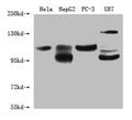 Western Blot
Positive WB detected in: Hela whole cell lysate, HepG2 whole cell lysate, PC-3 whole cell lysate, U87 whole cell lysate
All lanes: Alix antibody at 1:1000
Secondary
Goat polyclonal to mouse IgG at 1/50000 dilution
Predicted band size: 30, 96 KDa
Observed band size: 96 KDa
Exposure time：5min