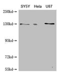 Western Blot
Positive WB detected in: SY-5Y whole cell lysate, Hela whole cell lysate, U87 whole cell lysate
All lanes: MCM9 antibody at 1:1000
Secondary
Goat polyclonal to mouse IgG at 1/50000 dilution
Predicted band size: 128, 73, 44, 85 kDa
Observed band size: 128 kDa
Exposure time：5min