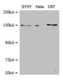 Western Blot
Positive WB detected in: SY-5Y whole cell lysate, Hela whole cell lysate, U87 whole cell lysate
All lanes: MCM9 antibody at 1:1000
Secondary
Goat polyclonal to mouse IgG at 1/50000 dilution
Predicted band size: 128, 73, 44, 85 kDa
Observed band size: 128 kDa
Exposure time：5min