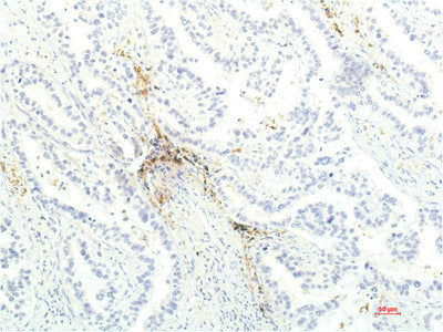 JAK1 Monoclonal Antibody – Figure 1 of 2