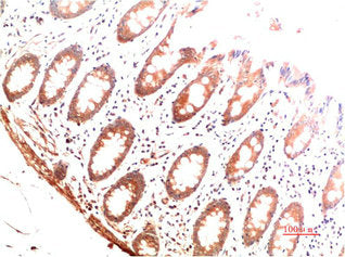 COL1A1 Monoclonal Antibody – Figure 1 of 2