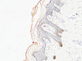 COL1A1 Monoclonal Antibody – Figure 1 of 3