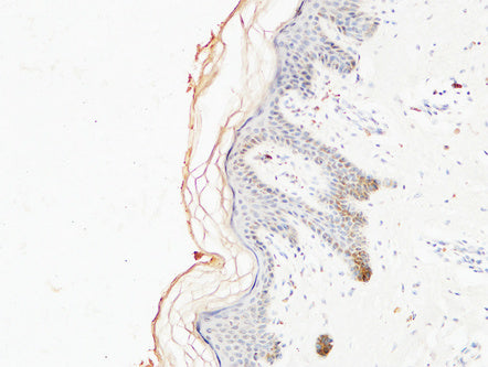 COL1A1 Monoclonal Antibody – Figure 1 of 3