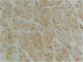 Immunohistochemical analysis of paraffin-embedded Mouse Skeletal Muscle Tissue using Desmin（mAb diluted at 1:200.