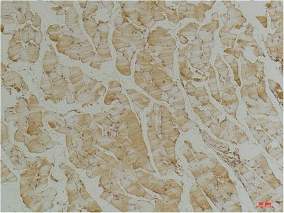 Immunohistochemical analysis of paraffin-embedded Mouse Skeletal Muscle Tissue using Desmin（mAb diluted at 1:200.