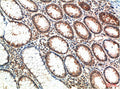 ATM Monoclonal Antibody – Figure 1 of 2