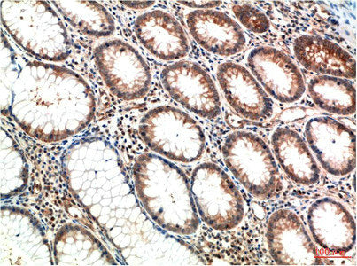 ATM Monoclonal Antibody – Figure 1 of 2