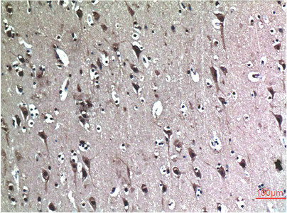 Immunohistochemical analysis of paraffin-embedded Human Brain Tissue using Beclin-1 Mouse mAb diluted at 1:200.