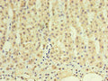 Immunohistochemistry of paraffin-embedded human adrenal gland using CSB-MA999881A0m in 30ug/ml dilute concentrations.