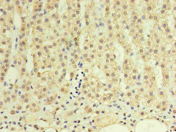 Immunohistochemistry of paraffin-embedded human adrenal gland using CSB-MA999881A0m in 30ug/ml dilute concentrations.