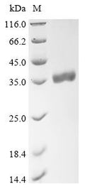 (Tris-Glycine gel) Discontinuous SDS-PAGE (reduced) with 5% enrichment gel and 15% separation gel.