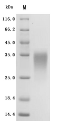 (Tris-Glycine gel) Discontinuous SDS-PAGE (reduced) with 5% enrichment gel and 15% separation gel.