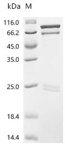 (Tris-Glycine gel) Discontinuous SDS-PAGE (reduced) with 5% enrichment gel and 15% separation gel.