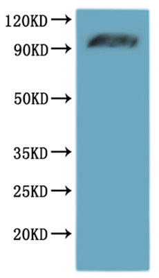 Recombinant Human Alpha-2A adrenergic receptor (ADRA2A)-VLPs – Figure 1 of 2