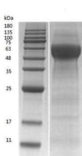 Recombinant Bovine Alpha-2-HS-glycoprotein (AHSG) (Active) – Figure 1 of 1