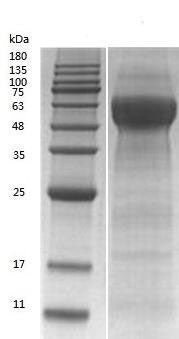 Recombinant Bovine Alpha-2-HS-glycoprotein (AHSG) (Active) – Figure 1 of 1