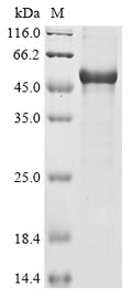 (Tris-Glycine gel) Discontinuous SDS-PAGE (reduced) with 5% enrichment gel and 15% separation gel.