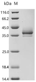 (Tris-Glycine gel) Discontinuous SDS-PAGE (reduced) with 5% enrichment gel and 15% separation gel.