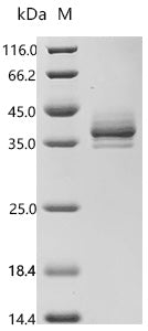 (Tris-Glycine gel) Discontinuous SDS-PAGE (reduced) with 5% enrichment gel and 15% separation gel.