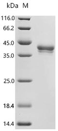 (Tris-Glycine gel) Discontinuous SDS-PAGE (reduced) with 5% enrichment gel and 15% separation gel.