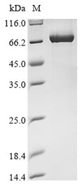(Tris-Glycine gel) Discontinuous SDS-PAGE (reduced) with 5% enrichment gel and 15% separation gel.
