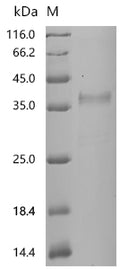 (Tris-Glycine gel) Discontinuous SDS-PAGE (reduced) with 5% enrichment gel and 15% separation gel.