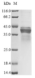 (Tris-Glycine gel) Discontinuous SDS-PAGE (reduced) with 5% enrichment gel and 15% separation gel.